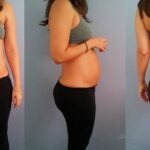 barriga-depois-do-parto