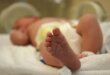 Bebê Recupera Lesão Cerebral Leite Materno