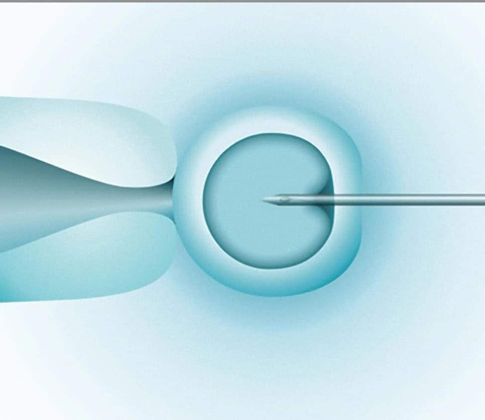 Fertilização In Vitro