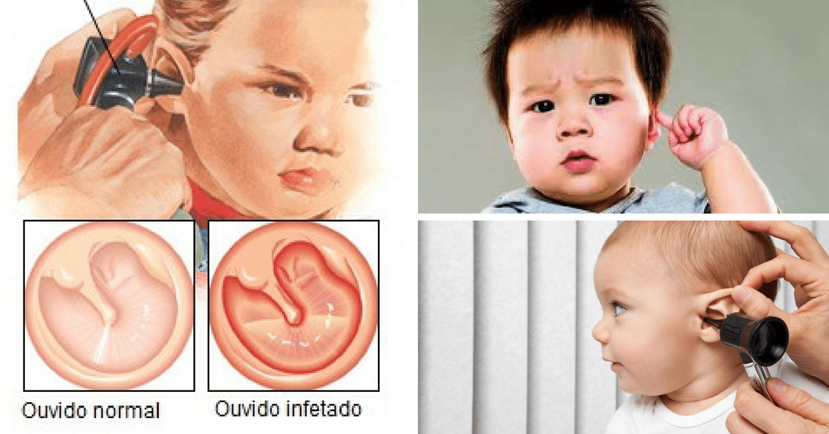 Dor De Ouvido Em Bebe: Causas, Sintomas E Tratamentos