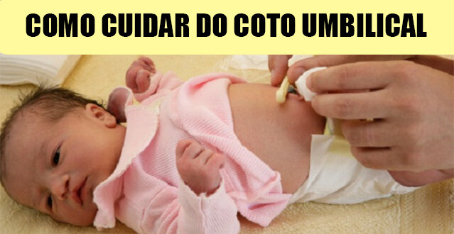 coto umbilical coto umbilical