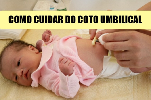 coto umbilical