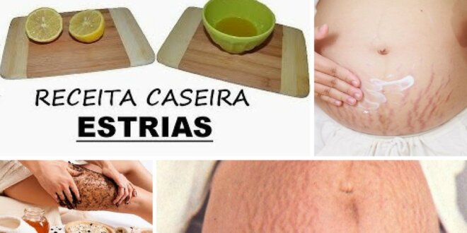 estrias receita caseira estrias receita caseira