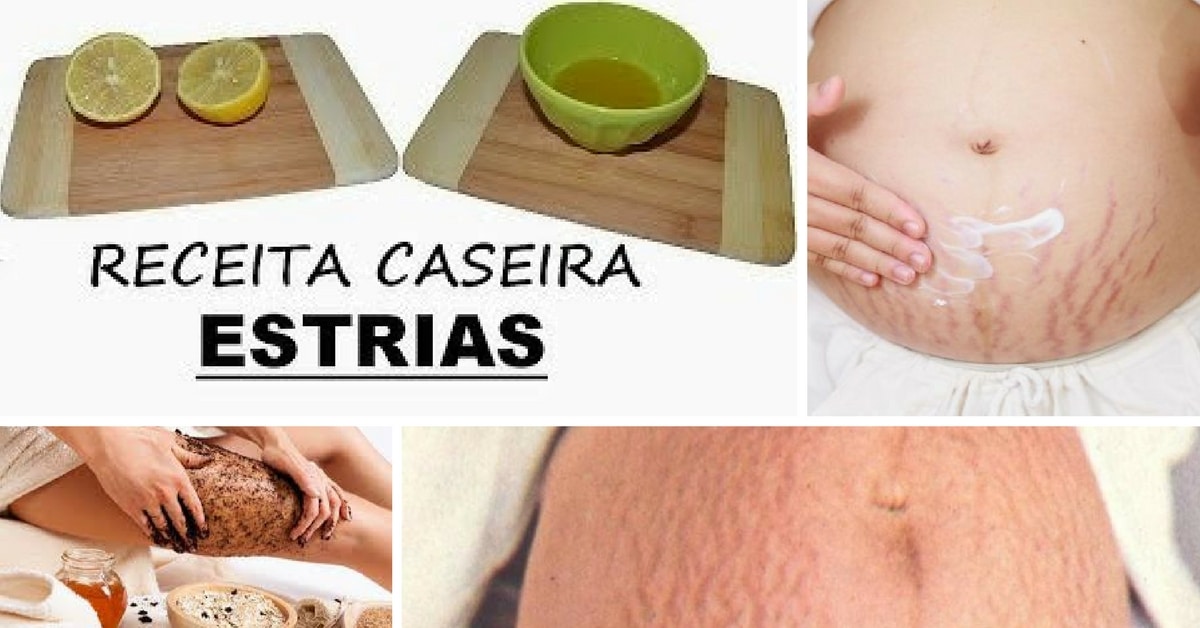 estrias receita caseira