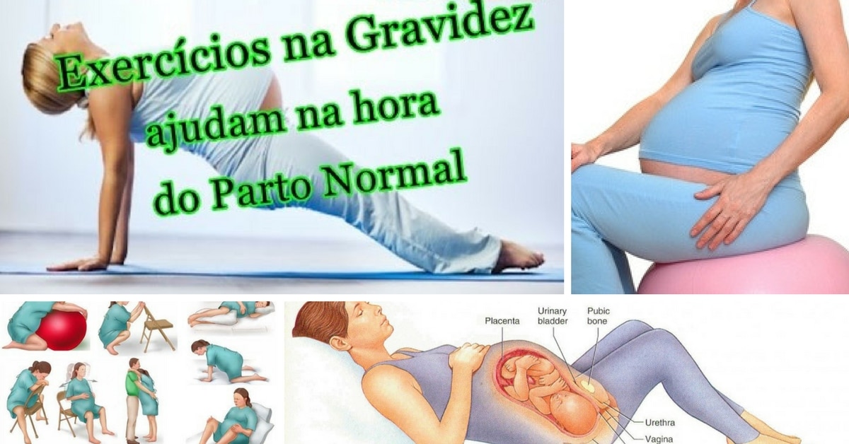 Exercícios para Facilitar o Parto Normal
