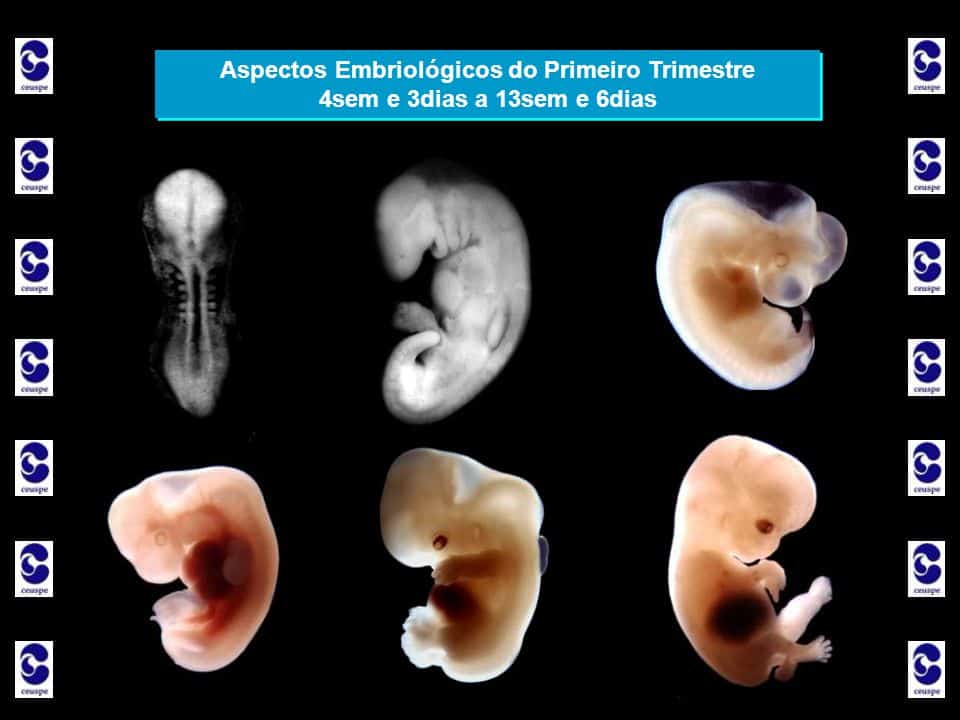 Gravidez: Primeiro Trimestre