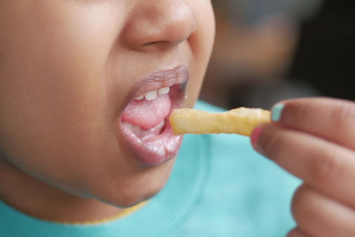 obesidade infantil 1