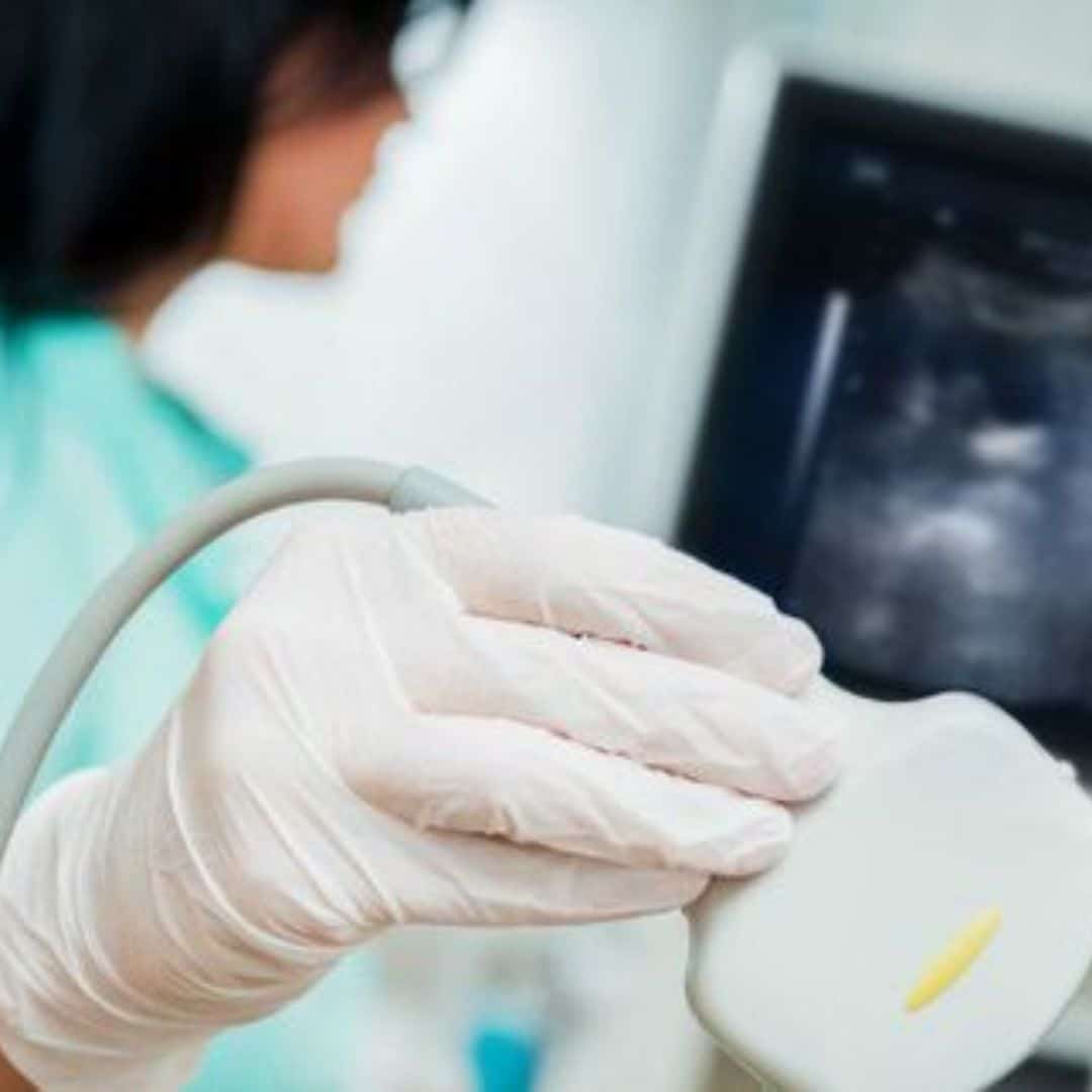 saber o sexo do bebe na primeira ultrassonografia