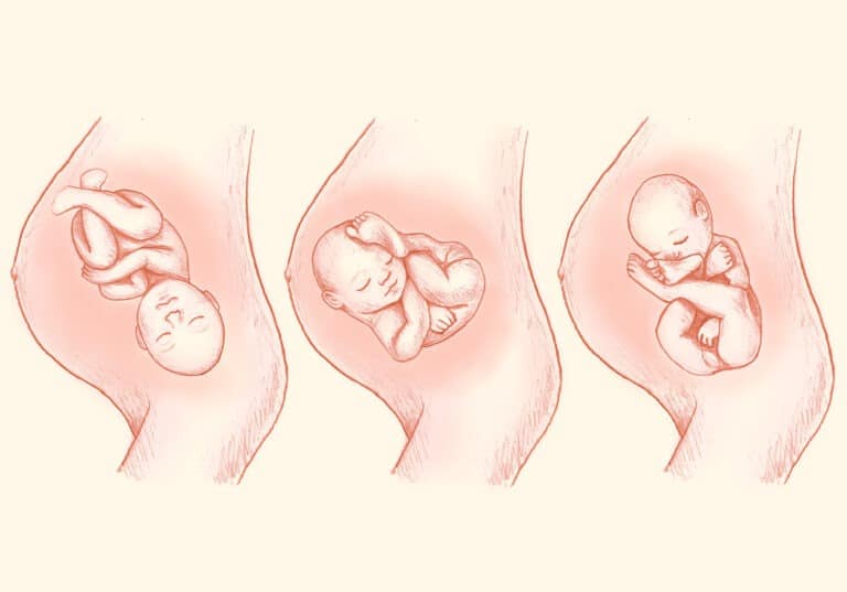 Exercicios Ajuda Bebe Virar Cabeca Baixo