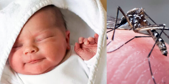 zika criancas zika criancas